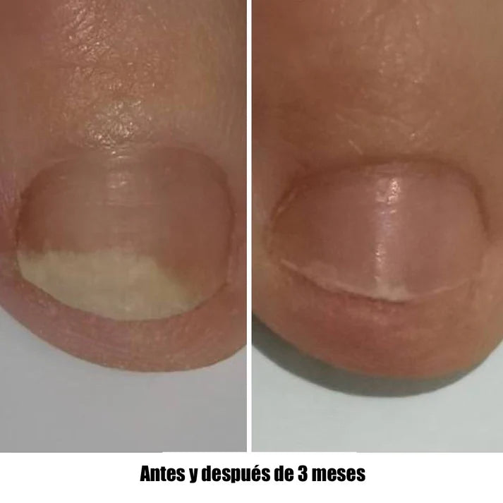 NAILSOFTHEDAY ONISTOP – Aceite regenerador, 8 ml