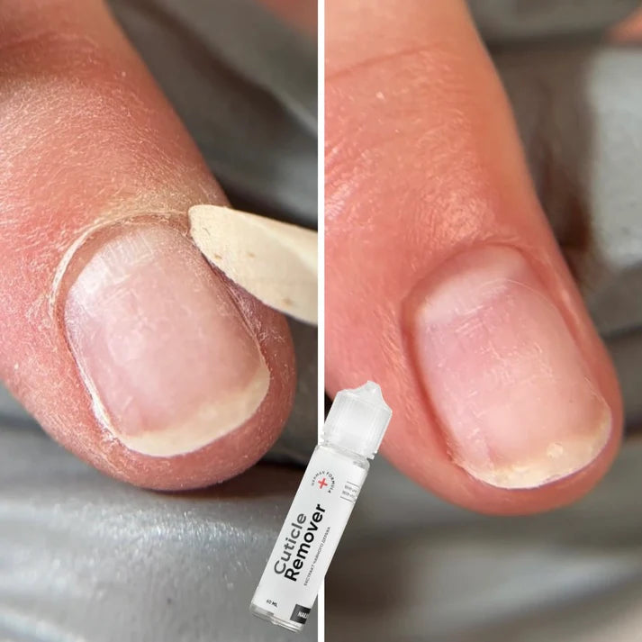 NAILSOFTHEDAY Removedor de Cutículas y Regenerador (con urea), 60 ml
